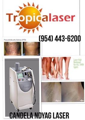 Tropicalaser of Pines - Call us: (954)443-6200 Free consultation, Cavi-Lipo, microdermabrasion, chemical peel, facials