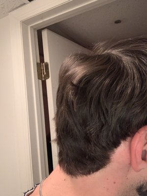 Thinner than the opposite side, choppy, lopsided from behind the ear, which is completely different on the other side of my head.