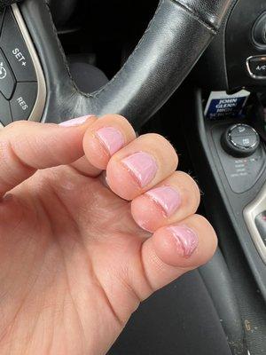 poorly done manicure