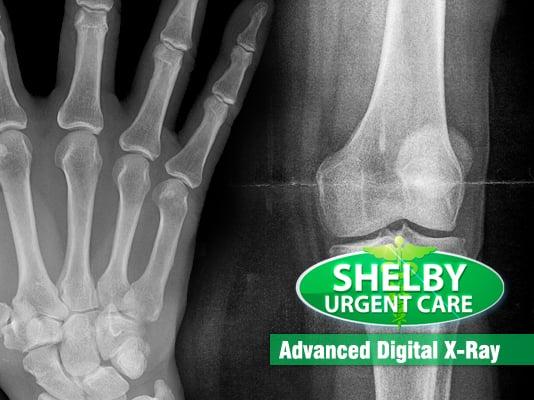 Digital XRay @ Shelby Urgent Care