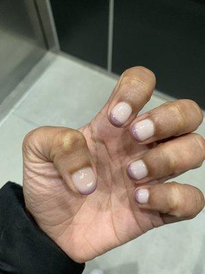 Gel tips