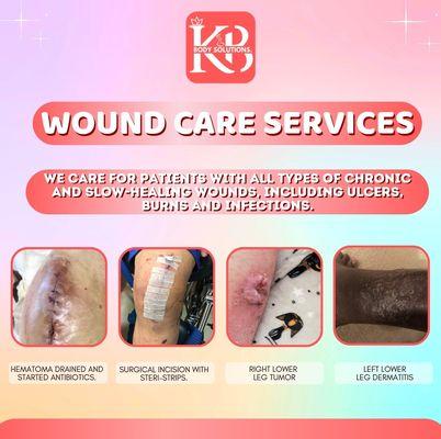 Bed sores
Surgical incisions 
Trauma wounds
Arterial wounds
Diabetic wounds
Lymphadema 
Amputations