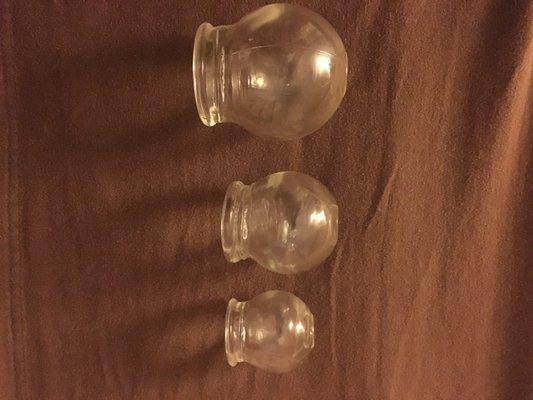 Cupping jars