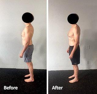 Before and After egoscue postural pgm