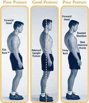 Physical therapy can change your posture