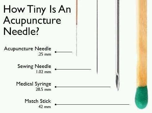 How Tiny Is An Acupuncture Needle?