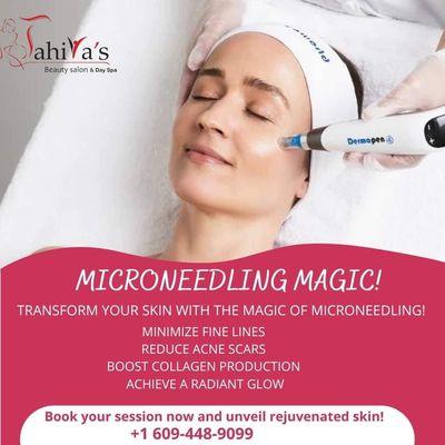 Microneedling