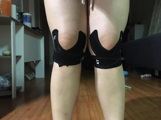 Kt tape both knees for support