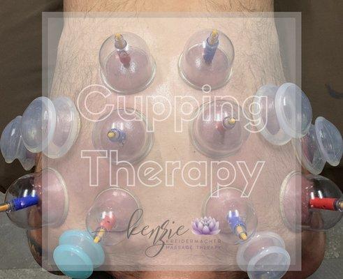 Cupping Therapy