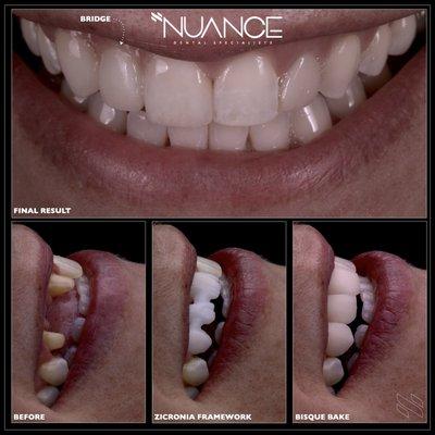 Nuance Dental Specialists