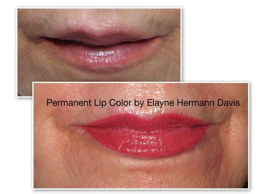 Permanent Lip Shading, Immediately After