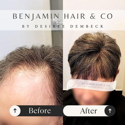 Custom Hair Toppers at Benjamin Hair & Co. Styled and colored to perfection, our hair toppers and wigs are ideal for those facing Alopecia,