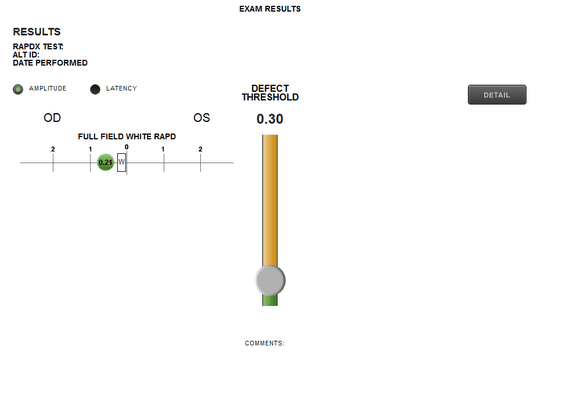 Amplitude Check