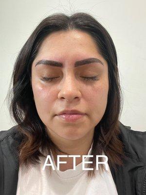 After the micro blading