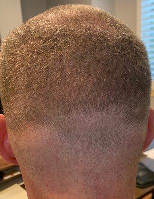 How's that for a fade? This should be in barber school textbooks of what not to do.