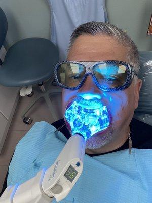 Teeth  whitening