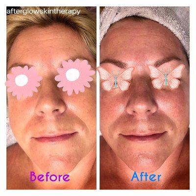 Afterglow Skin Therapy