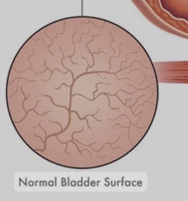 Normal bladder