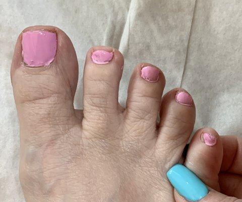 Worst pedicure ever