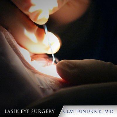 considered LASIK before?