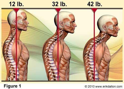 Did you know the more forward head translation you have the more stress it puts on your spinal cord, neck, and upper back!