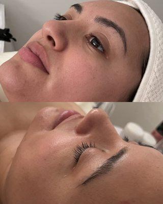 Signature Ageless Facial