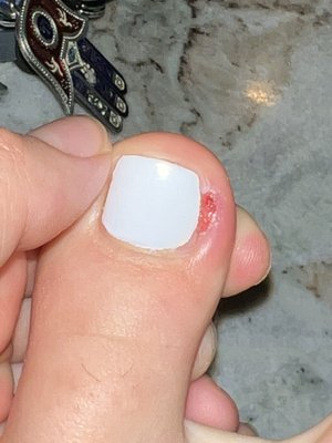 Toe