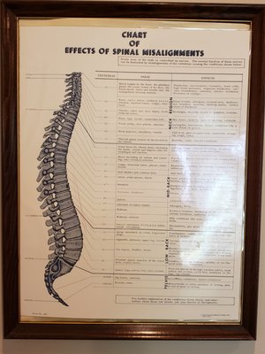 Effects of Spinal Misalignment. Don't wait for obvious symptoms.