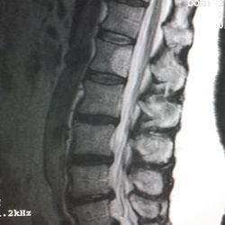 Lower spine image