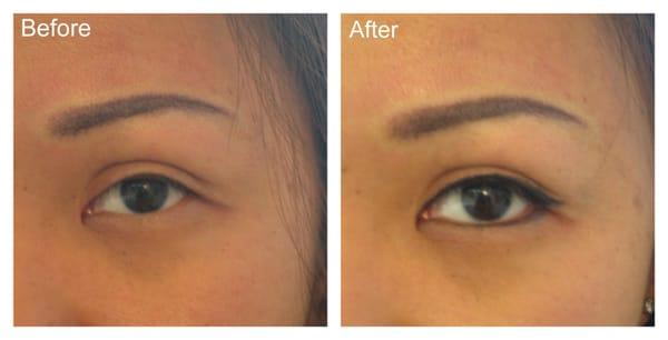 Before/After eyebrow and eyeline.