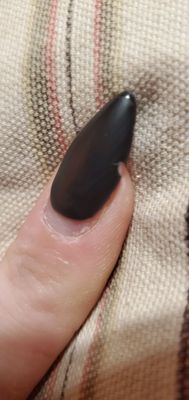 Chipped nail