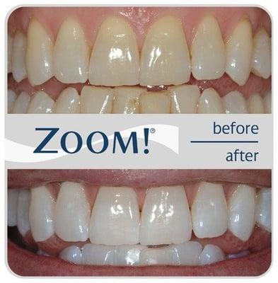 Not satisfied with your smile? Our state of the art technology will have you satisfied and showing off your new smile.