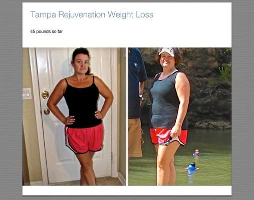 Tampa Rejuvenation Testimonial