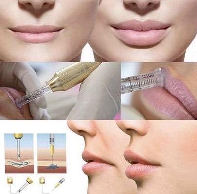 Hyaluron Pen! No Needle Filler For Face & Lips