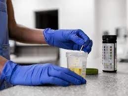 Atterdnod Drug Testing Services