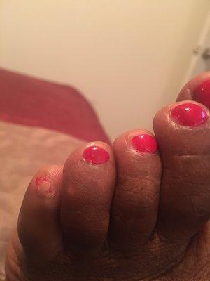 Polish came off little toe on left foot.