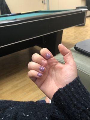 Nail fell off