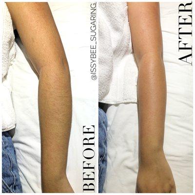 Full Arm Sugaring