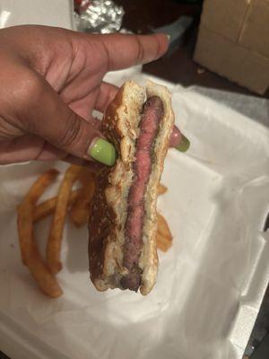 Second undercooked burger