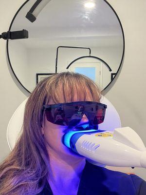 Teeth whitening!