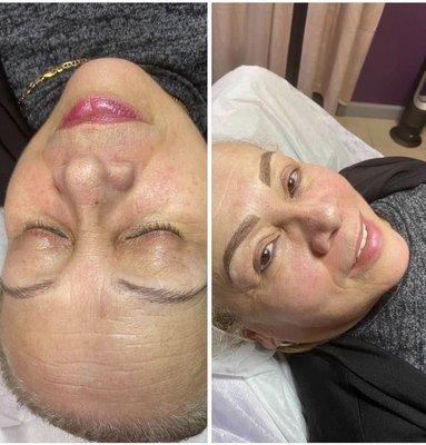 Microblading