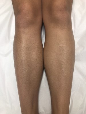 Legs Waxed