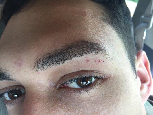 My husbands eyebrows after getting them done at feah brow beauty. It's been a few days and the scans are still there.