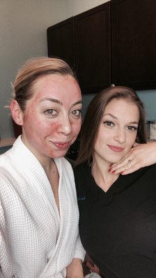 Microneedling with PRP!  The results were absolutely incredible!