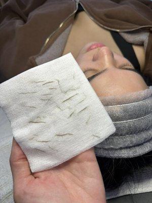 Dermaplane facial -removes dead skin and hairs