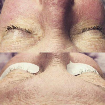 Eyelash lift