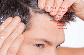 Hair Revitalization for Men