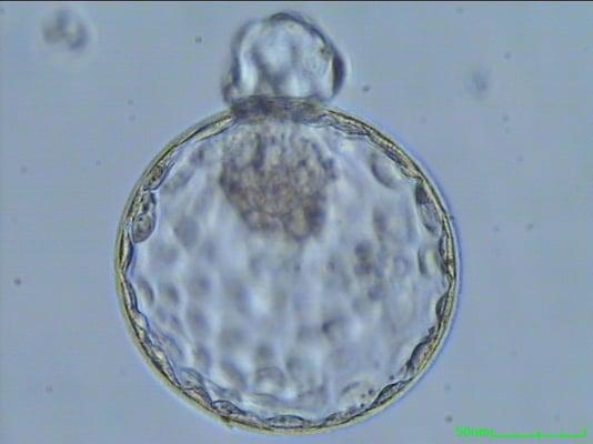 Embryo 5th day after fertilization