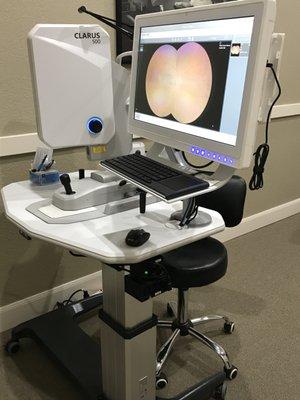 Clarus 500 retinal camera