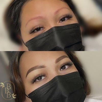 Brow correction